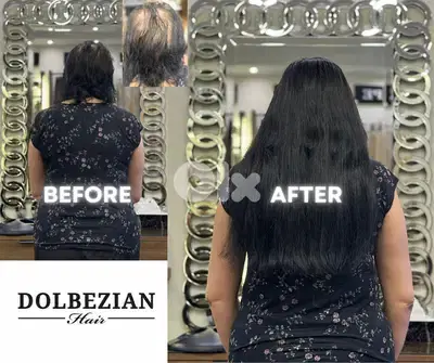 اكستنشن شعر طبيعي Human hair extension
