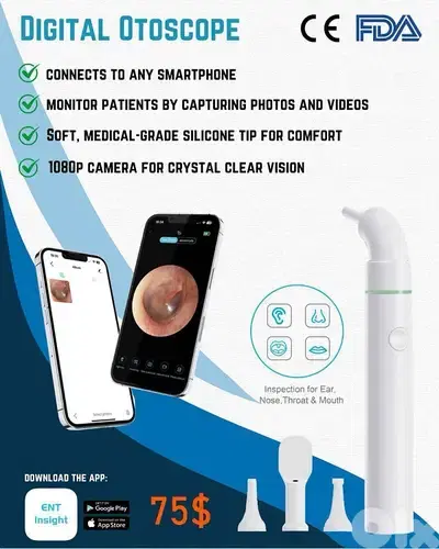 Digital Otoscope منظار أذن ديجيتال